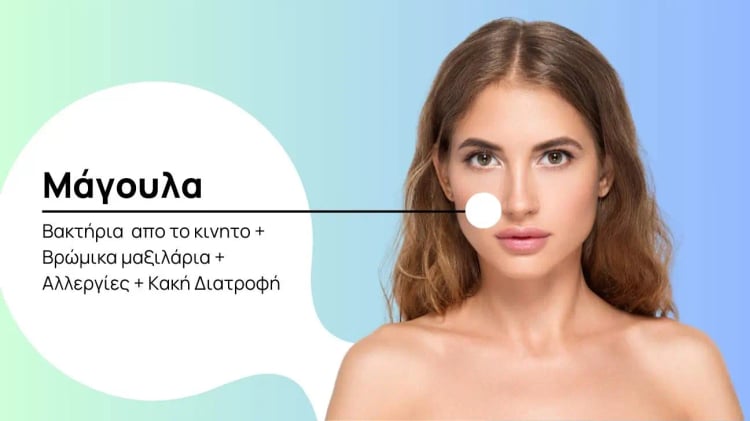 Σπυράκια στα Μάγουλα